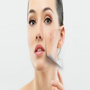 Trị mụn hiệu quả không ngờ từ đường phèn